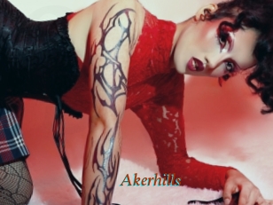 Akerhills