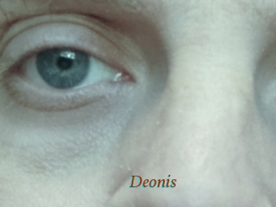 Deonis